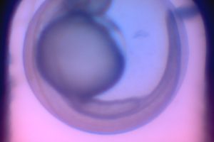 Brightfield embryo